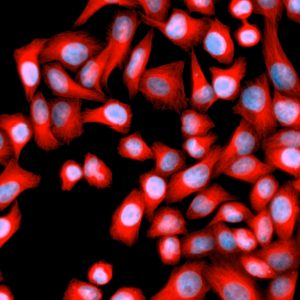 Células HeLa de control teñidas para DAPI (azul) con anticuerpo anti-tubulina (rojo) y fotografiadas conCelldiscoverer 7 de ZEISS.